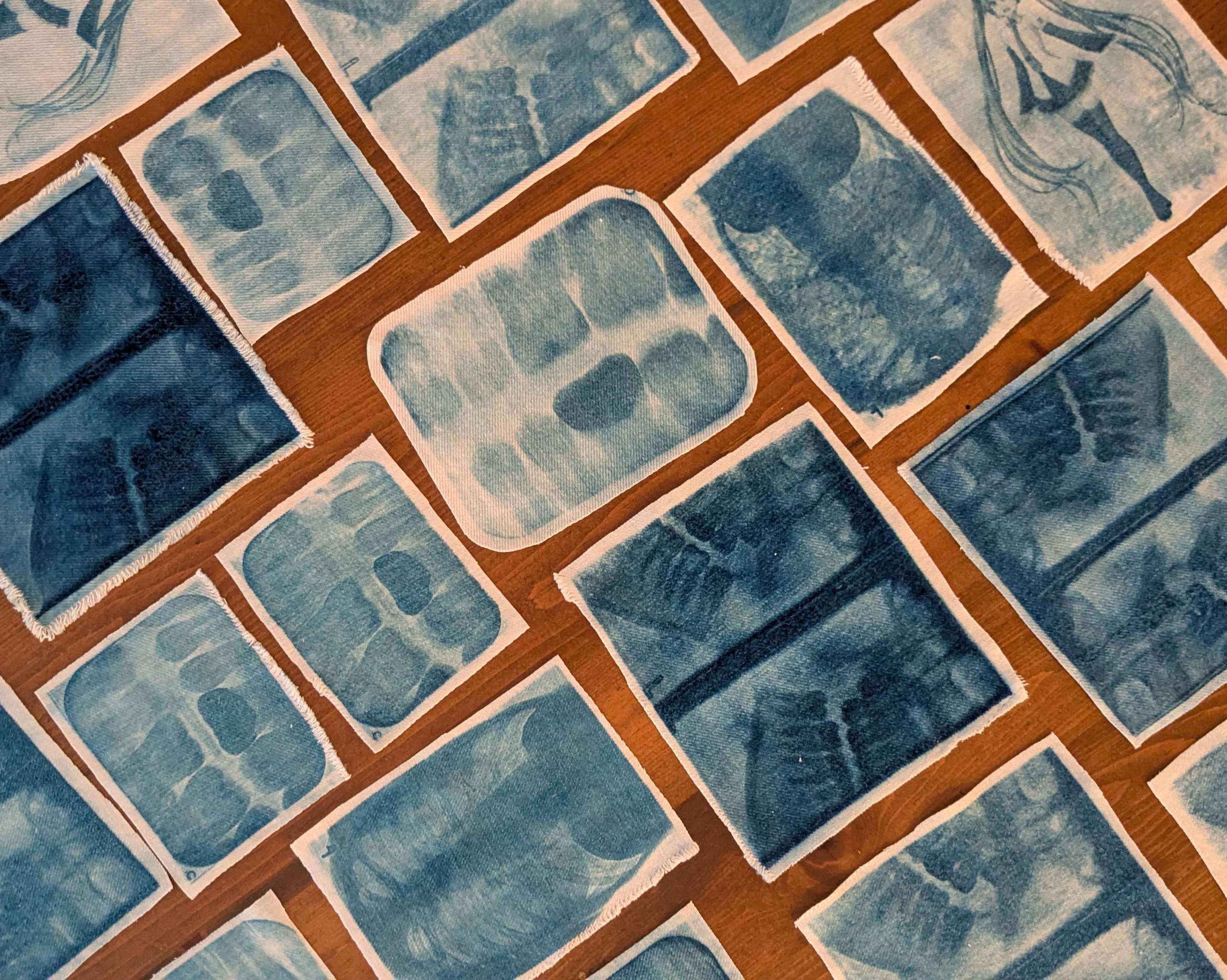 cyanotype prints of my dental xrays